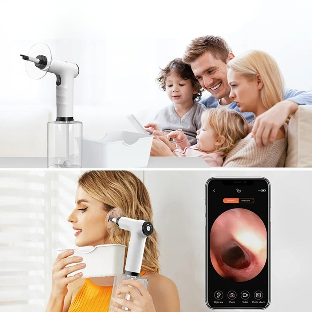 AuriNova™ - Ear Wax Remover