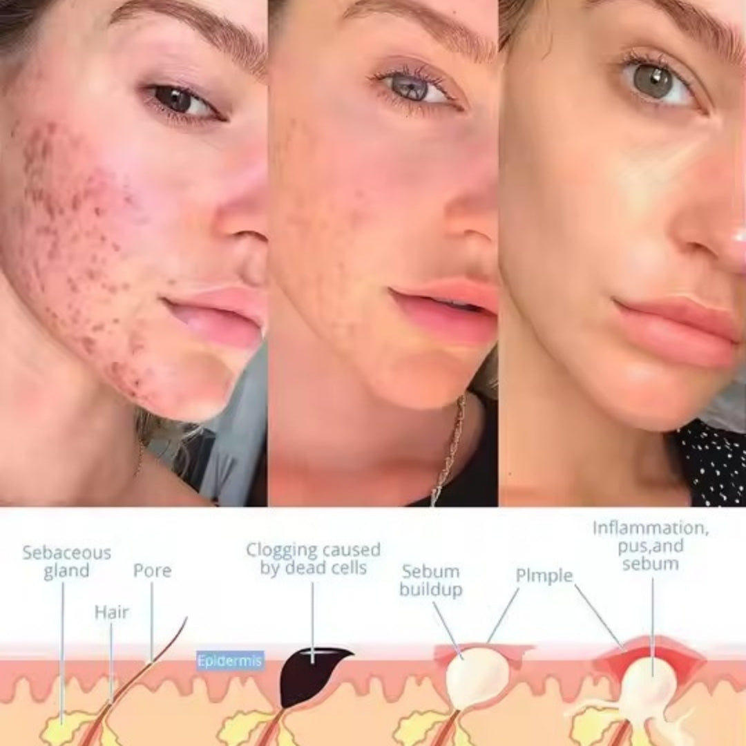 VitaRay™ - Facial Wand