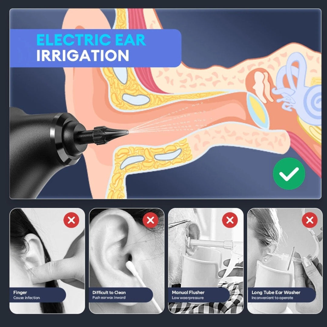 Waxonic™ - Ear Wax Remover