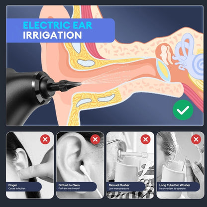 Waxonic™ - Ear Wax Remover