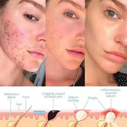 VitaRay™ - Facial Wand